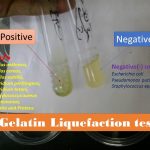 Gelatin liquefaction Test