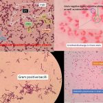 Hucker modification Gram stain