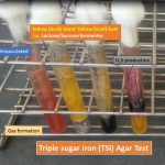Triple Sugar Iron Agar test