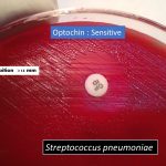 optochin susceptibility test