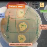 DNase test agar