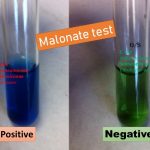 Malonate test