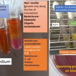Motility tests positive