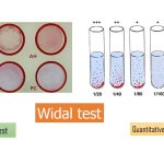 Widal test
