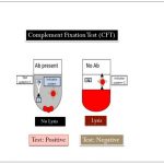 Complement Fixation Test