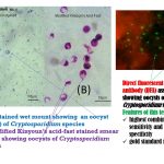 Cryptosporidium oocysts in Modified Kinyoun acid-fast stain and DFA