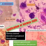 Giemsa stain