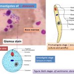 Leishmaniasis due to Leishmania donovani