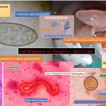 Parasitic infections lab diagnosis