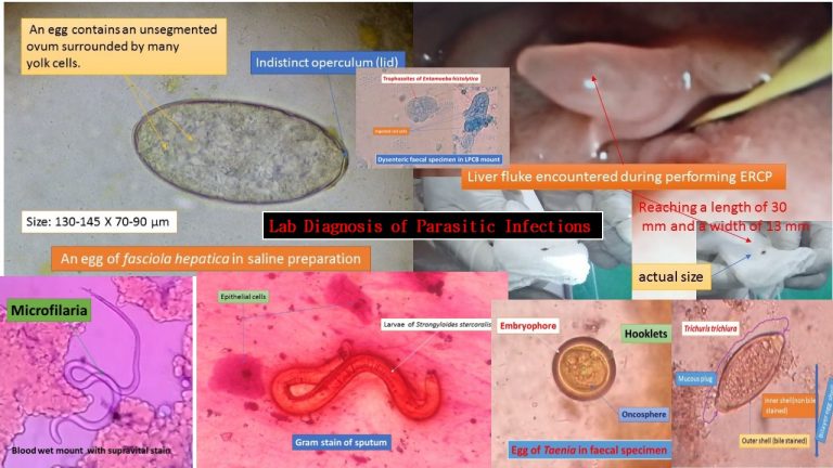 Parasitic Infections Lab Diagnosis Introduction Importance And
