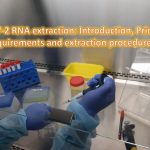 SARS-CoV-2 RNA extraction