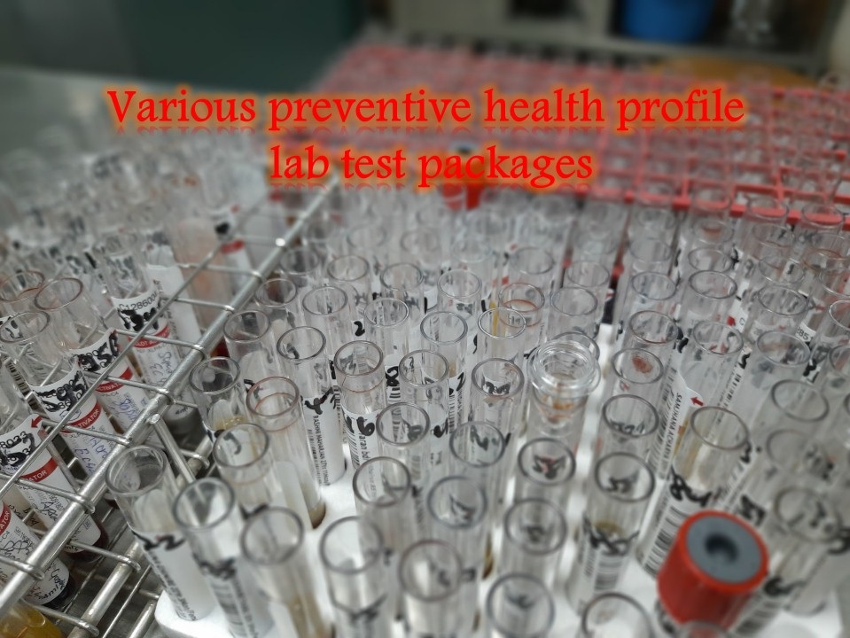 Various preventive health profile lab tests