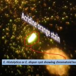 Acridine orange stain