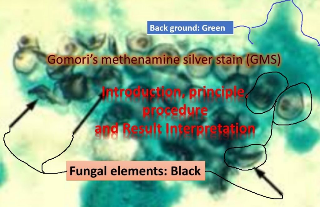 Gomori’s methenamine silver stain