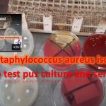 Pus, Ulcer Material, Skin Specimens Culture and sensitivity test