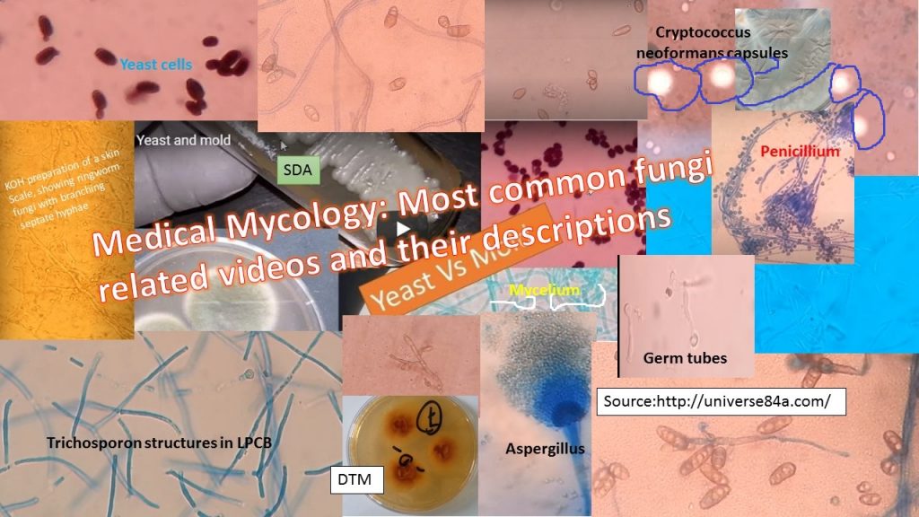 Medical Mycology: Most common fungi related videos and their descriptions