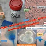 LPCB stain stands for lactophenol cotton blue and it is a combination of  fixative , staining and clearing agent. LPCB uses both as a mounting fluid and a stain. This is used for staining and microscopic identification of fungi. Its contents functions are as follows