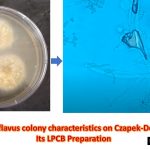 Czapek Dox Agar is a semisynthetic medium used for the cultivation of fungi, containing sodium nitrate as the sole source of nitrogen. Sucrose serves as the sole source of carbon while sodium nitrate serves as the sole source of nitrogen. Dipotassium phosphate buffers the medium. Magnesium sulphate, potassium chloride, ferrous sulphate serves as sources of essential ions. Agar acts as solidifying agent. In modified  Czapek Dox Agar,  magnesium glycerophosphate and potassium sulphate replace the magnesium sulphate and potassium phosphate of the original which prevents the precipitation of magnesium phosphate and it is also a highly satisfactory substrate for chlamydospore production by Candida albicans.