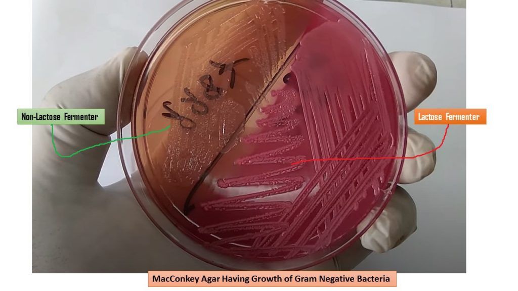 MacConkey Agar Having Growth of Gram Negative Bacteria