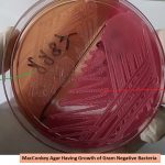MacConkey Agar Having Growth of Gram Negative Bacteria
