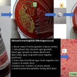 Meningococcus is the common name of Neisseria meningitidis and causes meningitis (infections of the lining of the brain and spinal cord) and bloodstream infections (bacteremia or septicemia). The genus Neisseria is named after the German bacteriologist Albert Neisser, who discovered Neisseria gonorrhoeae, the pathogen that causes the human disease gonorrhea in 1879. Later, in 1887 Weichselbaun isolated meningococcus from the cerebro-spinal fluid (CSF) of a patient. Meningococcus spreads through the exchange of respiratory and throat secretions like spit (e.g. by living in close quarters, kissing). Antimicrobial agents as well as vaccine both are available to save life from this bacterial infections.