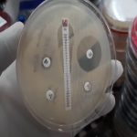 Introduction of Microbiology Practical Examination As you know, practical builds up your confidence level and therefore it is the integral part of your course of study. The Microbiology Practical Examination will cover the topics from all the parts of microbiology like bacteriology, parasitology, virology, mycology and immunology. The contents of this examination are given below as requirements. It includes viva voce ( oral examination) and spots or objective structured practical examinations (OSPE).
