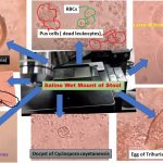 Saline wet mount preparation for stool uses analyzing a stool specimen in coprology (study of feces). It utilizes a physiological saline solution (0.85% NaCl ) as an isotonic media to maintain the cellular structure of the various organisms as well as our cells that are found in stool.