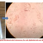 Vaginal Wet Mount: Introduction, Principle, Preparation, Result Interpretation, Limitations and Related Videos