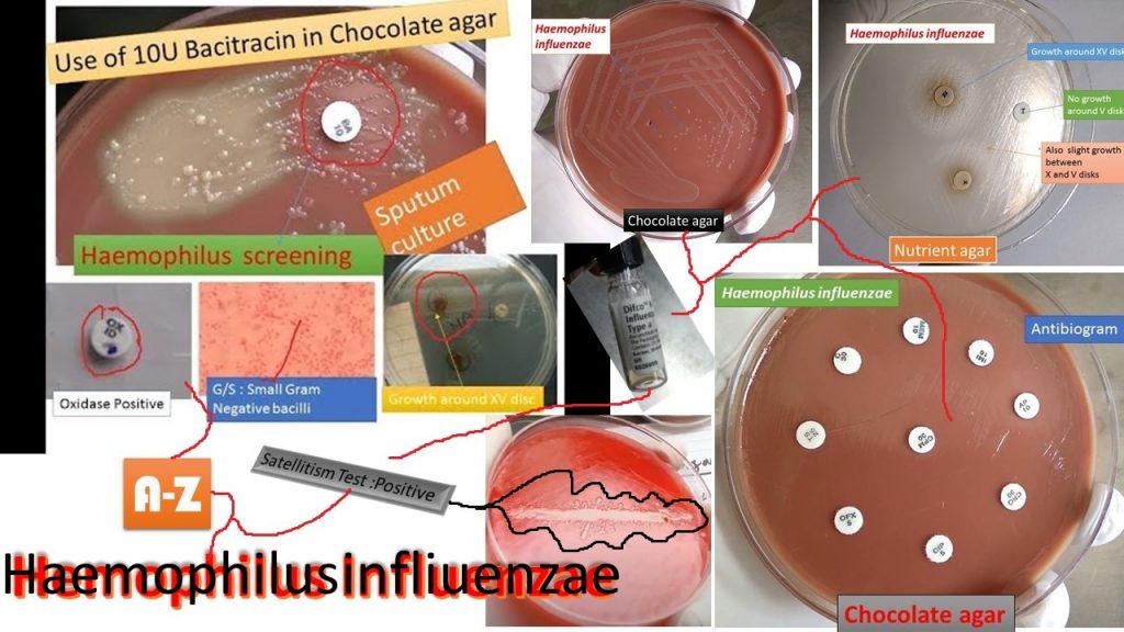 Haemophilus influenzae  colonies on chocolate agar after overnight incubation in a carbon dioxide atmosphere as shown above image. It must contain haemin or other iron-containing porphyrin and nicotinamide adenine dinucleotide  (NAD) or its phosphate (NADP). The porphyrin requirement is referred to as growth factor X and the NAD or NADP requirement as growth factor V. It was causative agent of  the devastating 1918 pandemic of influenza to now from local to systemic infections.