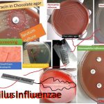 Haemophilus influenzae  colonies on chocolate agar after overnight incubation in a carbon dioxide atmosphere as shown above image. It must contain haemin or other iron-containing porphyrin and nicotinamide adenine dinucleotide  (NAD) or its phosphate (NADP). The porphyrin requirement is referred to as growth factor X and the NAD or NADP requirement as growth factor V. It was causative agent of  the devastating 1918 pandemic of influenza to now from local to systemic infections.