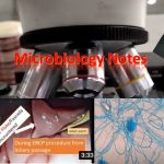 Microbiology Short Notes- The topic ' Microbiology Short Notes'  will serve as capsule for candidates who are participating post for medical lab technician,  medical lab technologist  and such related fields.