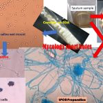 Mycology Short Notes- The topic ‘ Mycology Short Notes’  will serve as capsule for candidates who are participating post for medical lab technician,  medical lab technologist  and such related fields.