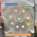 Novobiocin Susceptibility Test- Introduction, Principle, Procedure, Result Interpretation and Uses