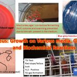 Proteus: Growth on Various media, Gram Stain and Biochemical Reactions