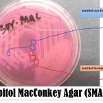 Sorbitol MacConkey Agar (SMAC) is recommended for isolation of E. coli O157:H7. Rappaport and Henig first described the formulation of the medium, and it was later confirmed by March and Ratham who reported MacConkey