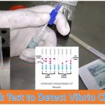 Vibrio cholerae Rapid Diagnostic Test (RDT) Introduction, Principle, Test Procedure, Result Interpretation