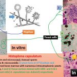 Histoplasma capsulatum was discovered by Pathologist, Samuel Taylor Darling in 1906. It is  a causative agent of histoplasmosis ( systemic disease) sometimes called Darling’s disease, in honor of discoverer. It a domorphic fungus and thus it grows as filamentous molds as saprobes and in culture at 25°C; while in humans or culture at 37 °C , it transforms to a unicellular morphology ( yeast cells