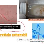 Sporothrix: Introduction, Morphology, Pathogenesis, Complications, Laboratory Diagnosis, Treatment and Prevention