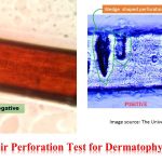 Hair perforation test is very useful test for dermatophytes to differentiate Trychophyton and Microsporum species.