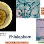 Phialophora is a dematiaceous fungus which  inhabits the soil, plants, and decaying food; and widely distributed in nature. Phialophora spp.  are the causative agents of some human infections like chromoblastomycosis, mycetoma, and phaeohyphomycosis.