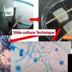 Slide Culture Preparation: Slide culture  preparation or technique method is also called microculture method. Slide culture preparation is useful in mycology due to following points of  views- in order to accurately identify many fungi it is essential to observe the precise arrangement of the copnidiophores and also to know the nature of spore production Riddel's  used a simple method of slide culturing but it permits fungi to be studied virtually in situ with as little disturbance as possible.  But here, we use a simple modification of his method using a single agar plate as described below.