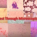 Spot Test Through Microscopic Slides