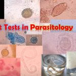Spot test in Parasitology