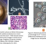Blastomyces dermatitidis: General Characteristics, Pathogenesis, Clinical Findings, Laboratory Diagnosis, Epidemiology, Prevention and Control