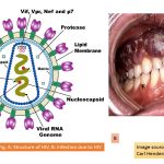 HIV (Human Immunodeficiency Virus): History, Introduction, Morphology, Pathogenesis, Lab Diagnosis, Epidemiology, Prevention and Prophylaxis