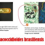 Paracoccidioides brasiliensis: General Characteristics, Pathogenesis, Clinical Findings, Laboratory Diagnosis, Epidemiology, Prevention and Control
