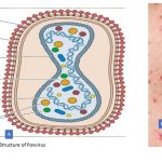 Poxvirus: History, Classification, Morphology, Pathogenesis, Laboratory Diagnosis, Treatment and Keynotes