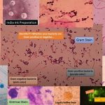 Stain in Microbiology for Specimen Processing-Name List, Introduction and uses