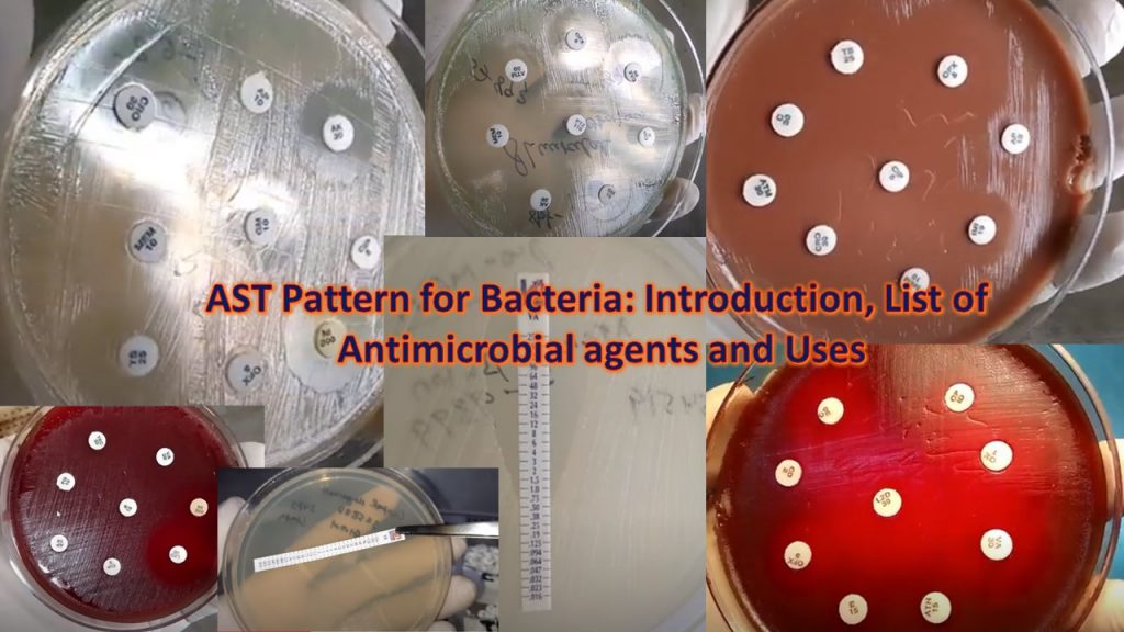 AST Pattern for Bacteria-Introduction, List of Antimicrobial agents and Uses