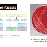 Bordetella was described by Bordet and Gengou (1900) in a sputum sample of children with whooping cough. In 1906 -B. pertussis ( Whooping cough) 1911 - B. bronchoseptica from dog 1937 - B. parapertussis ( mild whooping cough)